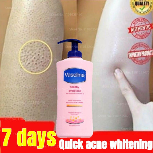 holwa  400ML Vaseline Body Lotion for Men and Women Remove Chicken Skin Moisturizing Whitening Body Moisturizing Fragrance Body Cream